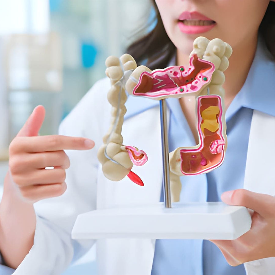 Types of Colorectal Cancer